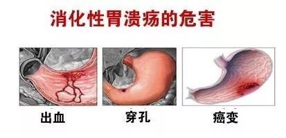 科普知识：消化内科常见疾病！