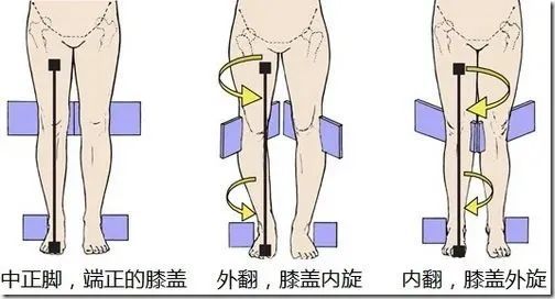 健康科普 | 拇外翻竟然与坐姿有关？