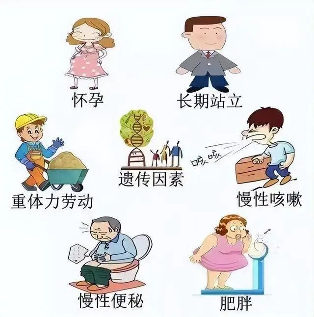 告别“蚯蚓腿”——下肢静脉曲张的治疗与预防