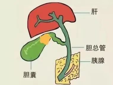 胆囊结石到底是什么原因造成的?