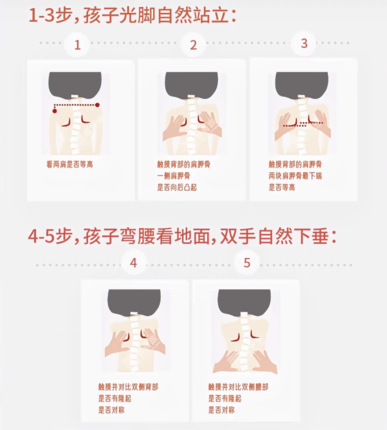 汇聚公益力量｜爱心矫治守护少年脊梁 长城骨科公益行动护航脊柱健康